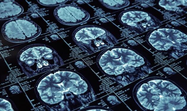 全國**肺部人工智能醫(yī)學影像產(chǎn)品獲批上市