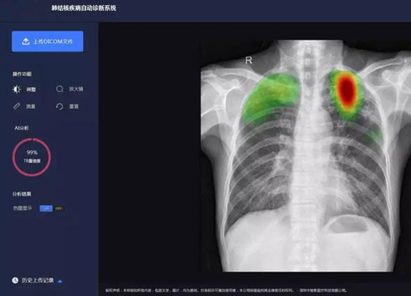 醫(yī)療器械分類(lèi)目錄-21醫(yī)用軟件-04決策支持軟件